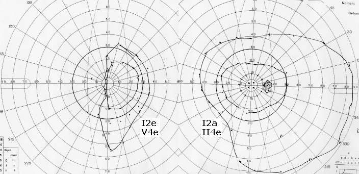 Visual Field Test Chart